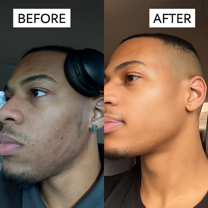 CleanCut™ Ingrown Tonic Roller